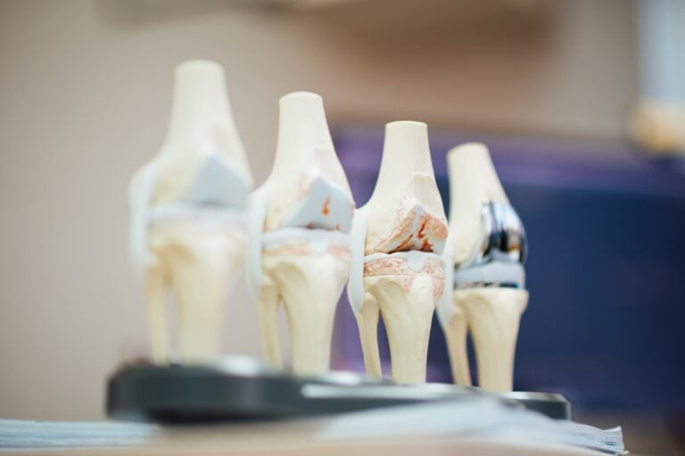 Czym zajmuje się ortopeda? Kto to jest i co leczy?