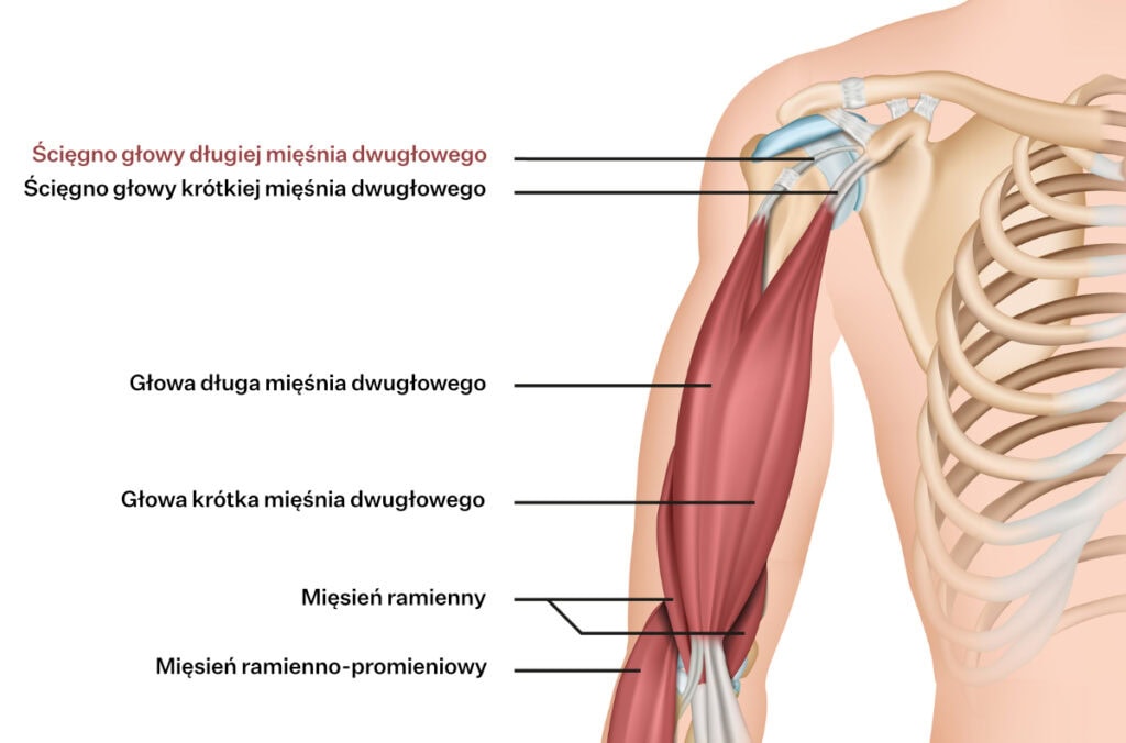 Umiejscowienie LHBT - ścięgna głowy długiej bicepsa